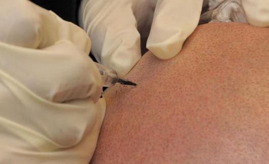 The Permanent Hair Tattoo Technique Funzug Com