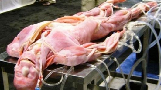 Synthetic Human Body By SynDaver Labs