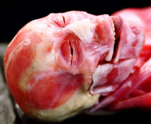 Synthetic Human Body By SynDaver Labs