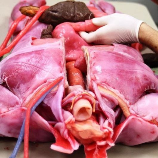 Synthetic Human Body By SynDaver Labs